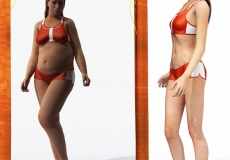 אנורקסיה - סיפור אישי של ילדה בת 14 