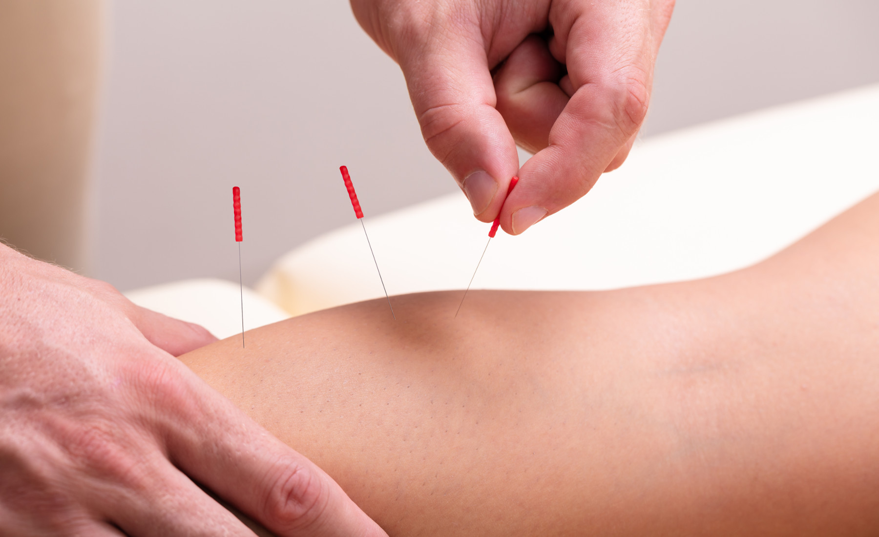 דיקור סיני – הטיפול המשלים לשחרור אנרגיה תקועה בילדים